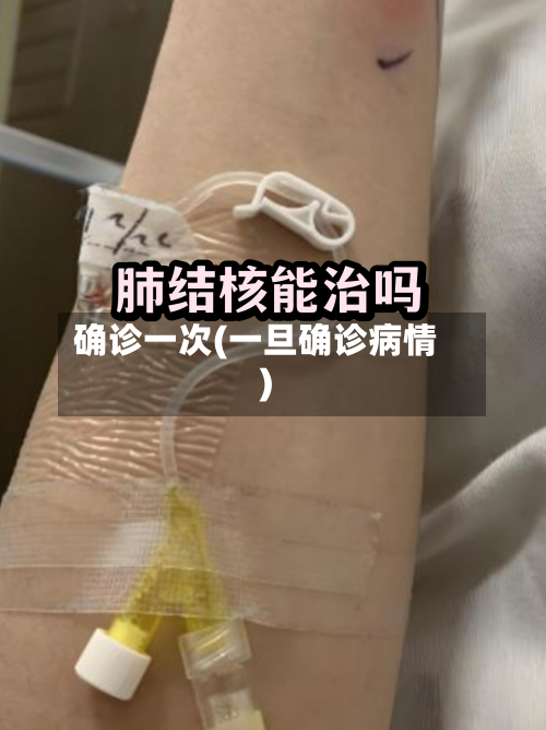 确诊一次(一旦确诊病情)-第1张图片