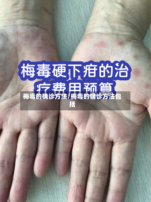 梅毒的确诊方法/梅毒的确诊方法包括