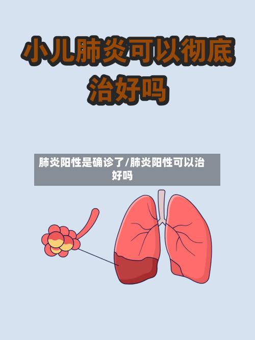 肺炎阳性是确诊了/肺炎阳性可以治好吗-第3张图片