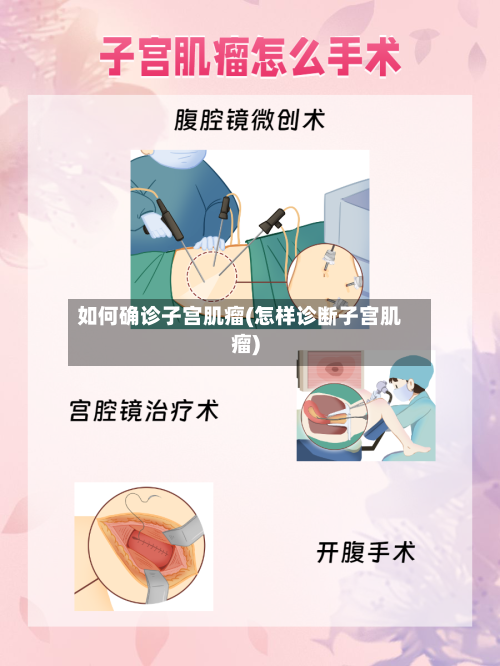 如何确诊子宫肌瘤(怎样诊断子宫肌瘤)
