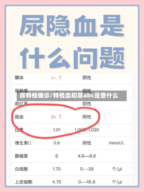 尿特检确诊/特检血和尿abc是查什么