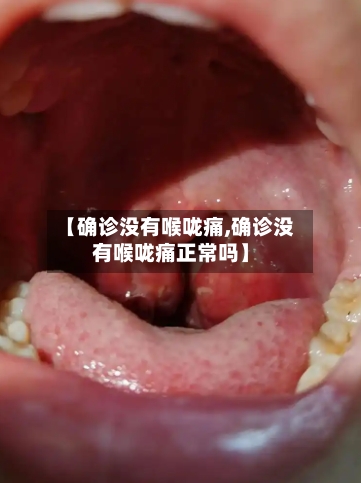 【确诊没有喉咙痛,确诊没有喉咙痛正常吗】