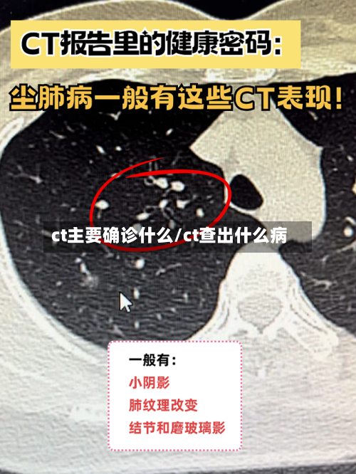 ct主要确诊什么/ct查出什么病