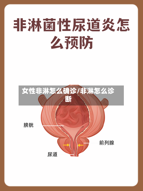 女性非淋怎么确诊/非淋怎么诊断