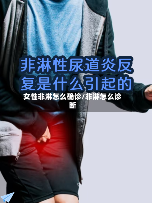 女性非淋怎么确诊/非淋怎么诊断-第3张图片