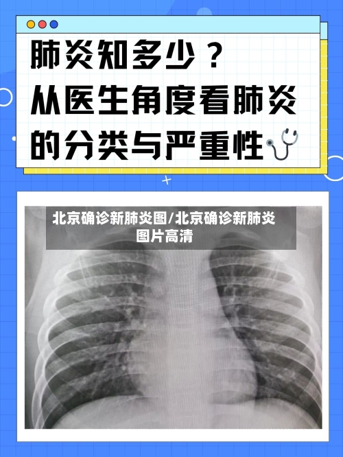 北京确诊新肺炎图/北京确诊新肺炎图片高清