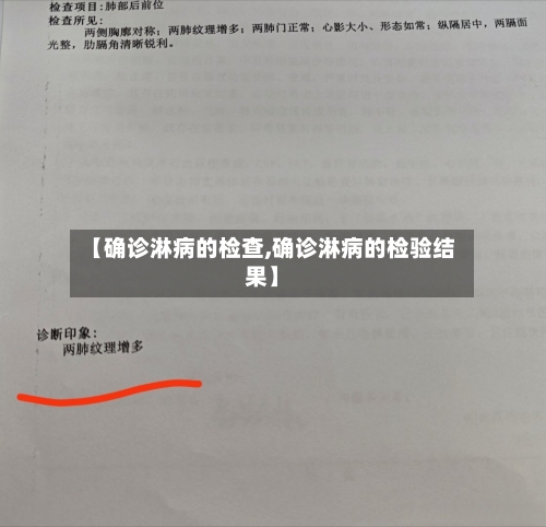 【确诊淋病的检查,确诊淋病的检验结果】-第1张图片