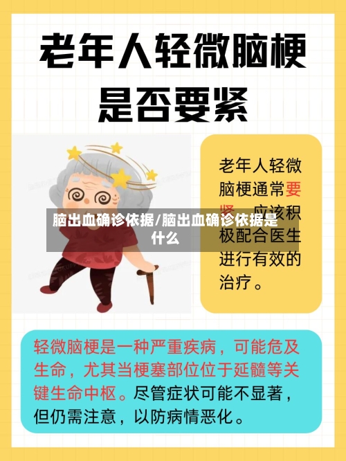 脑出血确诊依据/脑出血确诊依据是什么-第2张图片