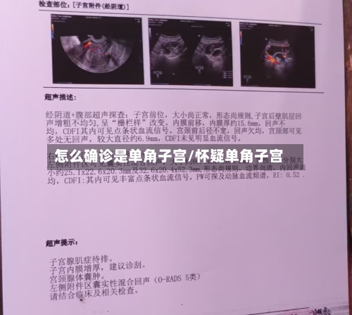 怎么确诊是单角子宫/怀疑单角子宫