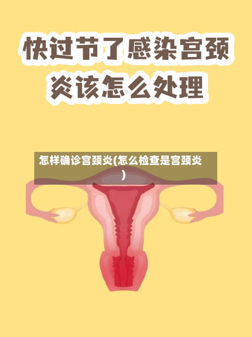 怎样确诊宫颈炎(怎么检查是宫颈炎)